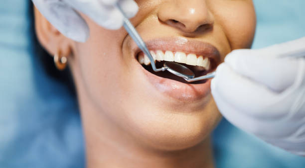 Best Emergency Dental Care for Broken or Chipped Teeth in Homosassa Springs, FL